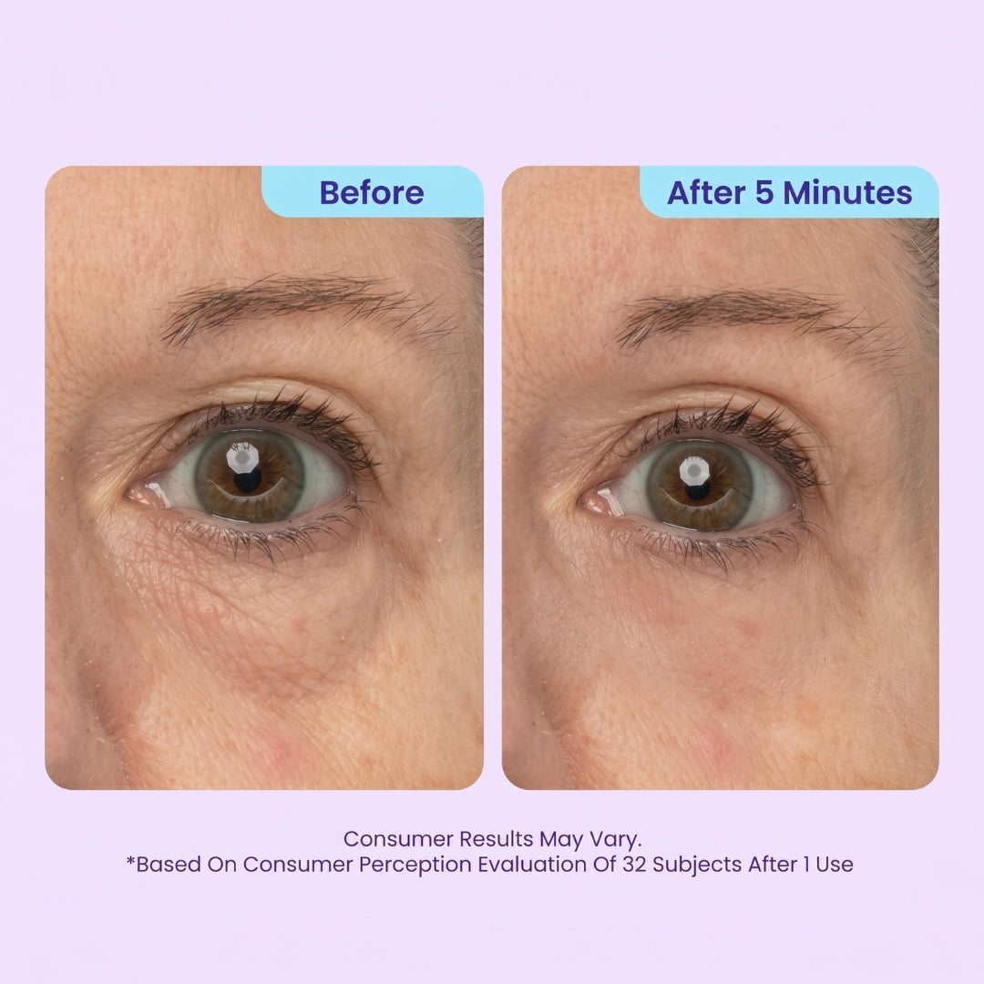SPECIAL LAUNCH PRICE | GPURE™ Instant Lift Eye Gel | For Puffiness & Bags, Wrinkles, Fine Lines and Dark Circles