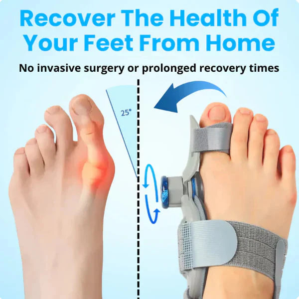 Toe area auxiliary corrector - Non-Surgical Relief for Bunion Pain