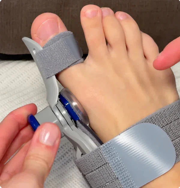 Toe area auxiliary corrector - Non-Surgical Relief for Bunion Pain