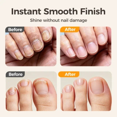 ⏳Time-Limited Special⏰2-in-1 Smart Electric Nail Trimmer u0026 Polisher for All Ages 👨‍👩‍👧‍👦 – Blade-Free, Blood-Free u0026 Stress-Free Nail Care! 💅
